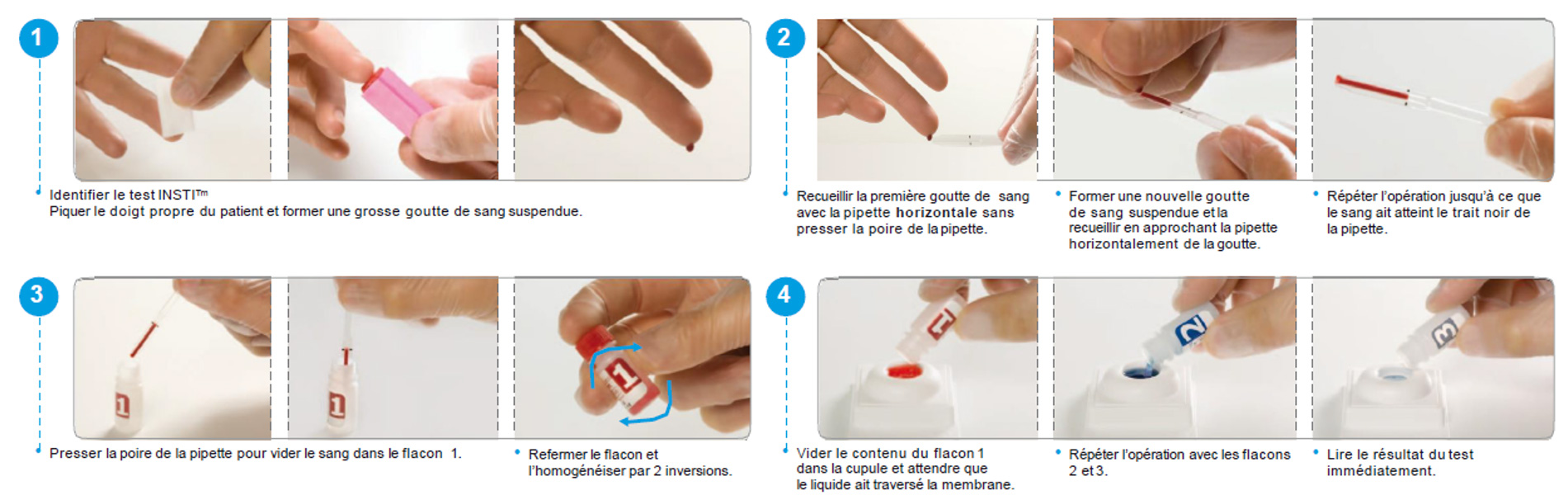 Auto test VIH - Dépistage sida : prévention MST, HIV